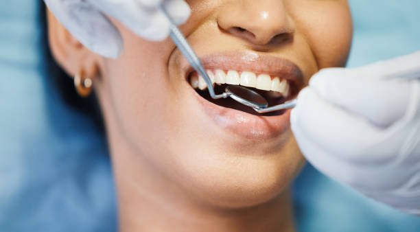 Best Emergency Denture Repair in Winter Springs, FL
